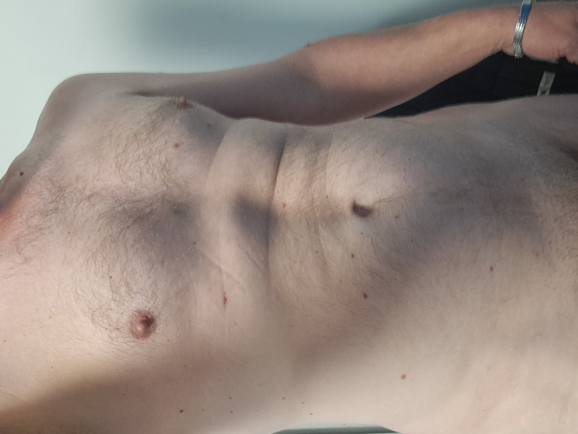 Maxaen de Rhône-Alpes, France